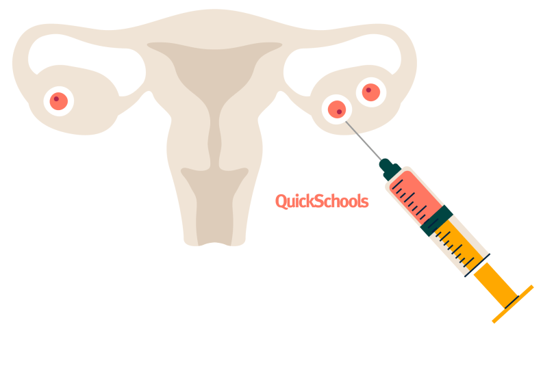 J.B.S Haldane contribution to IVF